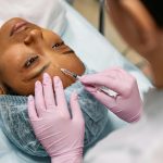 Botox voorhoofd: een frisse en ontspannen uitstraling zonder rimpels